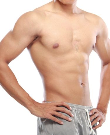 gynecomastia san francisco